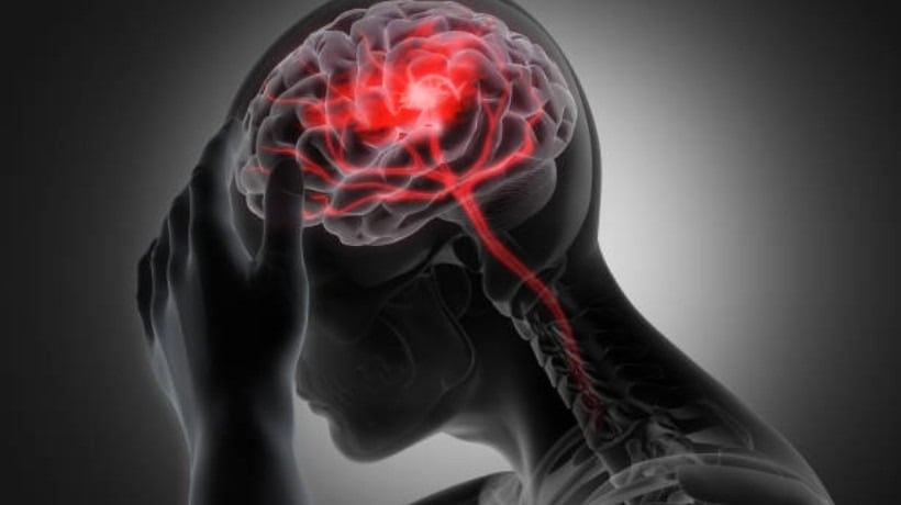 40% de los ingresos por urgencias en Clínica Bupa Antofagasta corresponden a accidentes cerebrovasculares