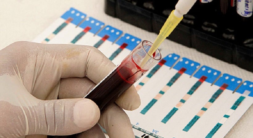 Atacama registra alza del  VIH: 131 ingresos durante solo este año