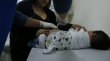 Dos guaguas fueron hospitalizadas por virus Sincicial en el Hospital Regional de Concepción en las últimas dos semanas: no estaban inmunizadas