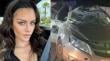 “Me enseñó a valorar mi vida”: la reflexión de Emilia Dides tras grave accidente automovilístico