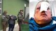 Detiene a dos sujetos de “entre 20 a 25 años” por brutal golpiza a conductor de micro en Villa Alemana