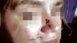 Víctima de femicidio frustrado: “Me cortó, desnudó y me metió la cabeza al inodoro”