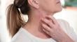 Vivir con dermatitis atópica: pacientes del HRA relatan la lucha diaria contra la picazón y el dolor