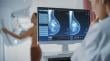 Especialista del Hospital Regional de Antofagasta alerta sobre mayor agresividad de cáncer de mama en mujeres jóvenes