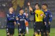 Por polémico cruce con árbitro Héctor Jona: Jugador de Huachipato sufre suspensión de cuatro partidos