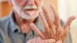 Parkinson: vuelve la cirugía e investigación con neuroestimuladores