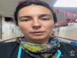 [VIDEO] Doctora alerta por ingresos de pacientes en Hospital de Iquique que han sufrido caídas de altura y descargas eléctricas