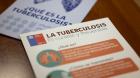 Avanzan en la detección de tuberculosis en los contactos estrechos de contagiados en el Biobío