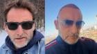 Daniel Fuenzalida reveló que se sometió a implante capilar: “Nuevo look”