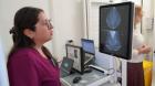 144 mamografías gratuitas estarán disponibles en Antofagasta para mujeres desde los 40 años: conoce cómo acceder