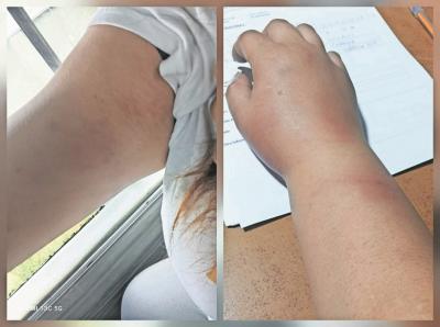 Mujer denuncia agresiones  y supuesto abuso sexual por sorpresa de carabinero